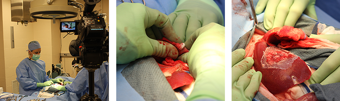 control severe bleeding