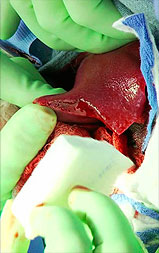 effective bleeding control